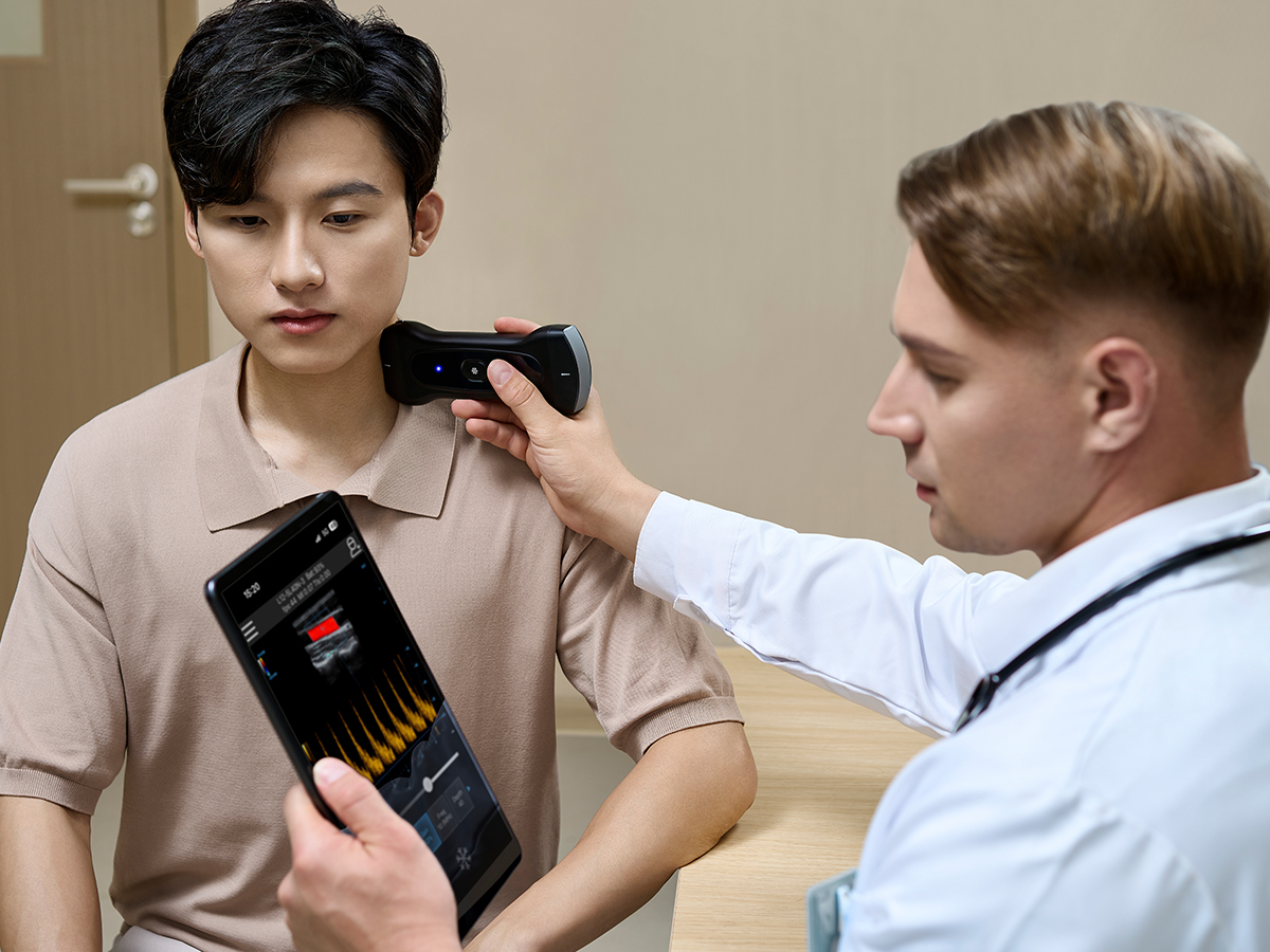 Handheld ultrasound device and probe close-up