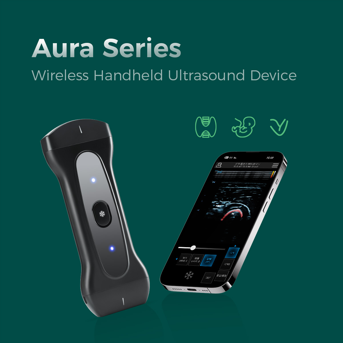 Wireless Handheld Ultrasound System Wireless Handheld Ultrasound System