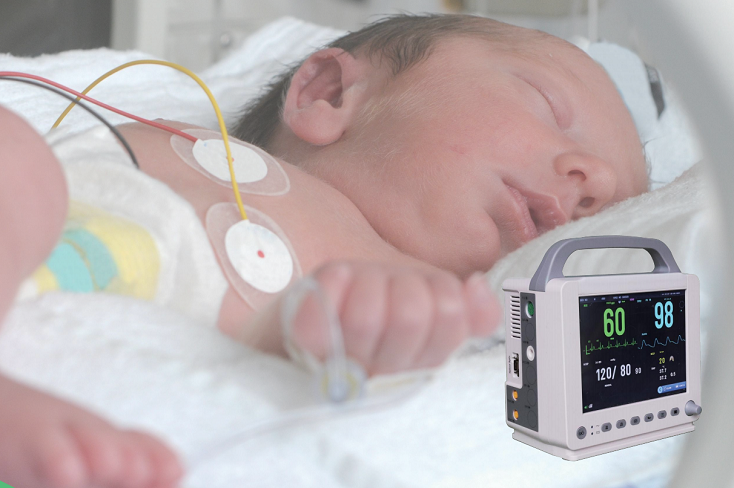 E10 Neonatal Patient Monitor E10 Neonatal Patient Monitor