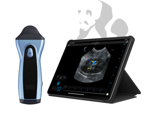 VPIU1D portable ultrasound device for panda