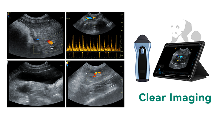 Panda ultrasound imaging
