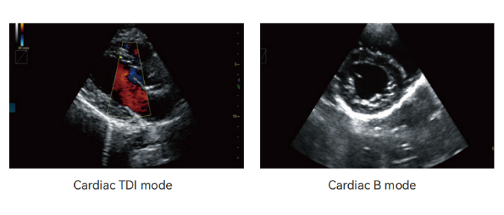 Revo 9 cardiac