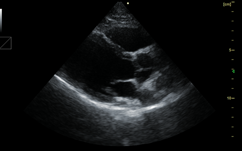 Cardiac B Imaging