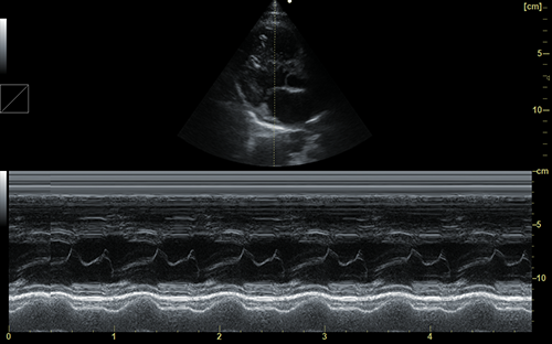 Cardiac M Imaging