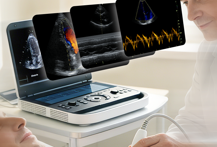 Cardiac imagings from Revo 9