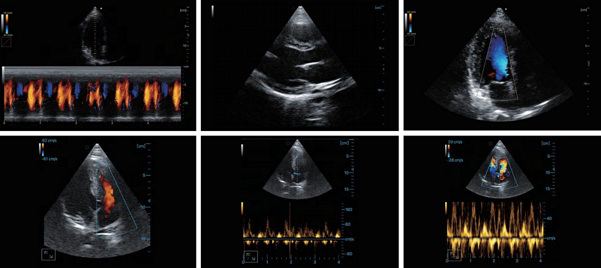 Wired ultrasound imagings
