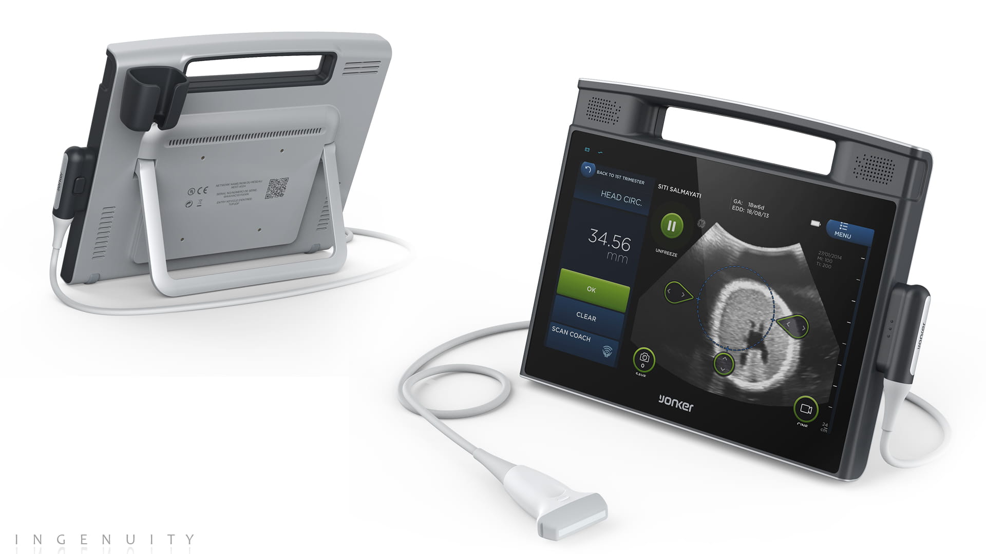 Touchable ultrasound