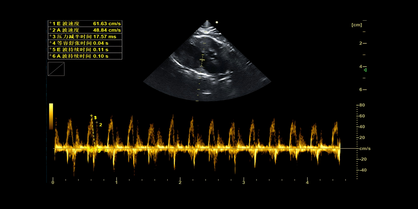Handheld Ultrasound Product Image
