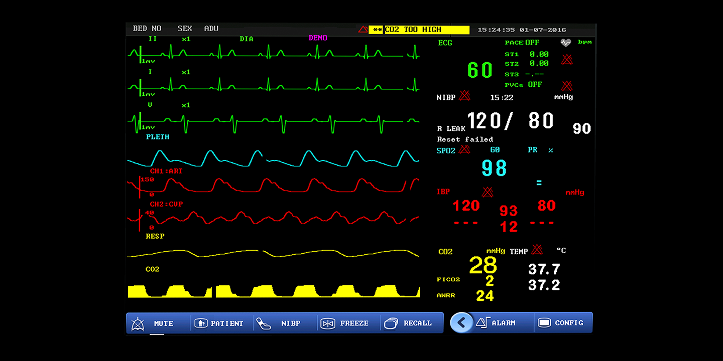 Multi-Parameter Monitor Product Image