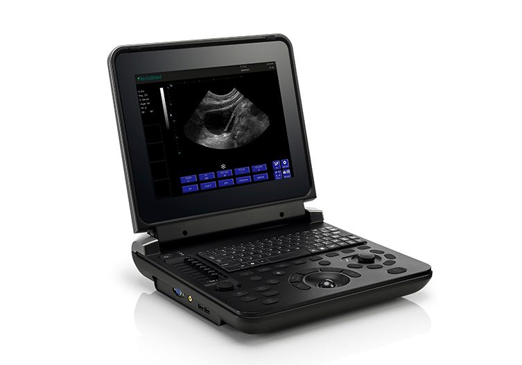 Ultrasound