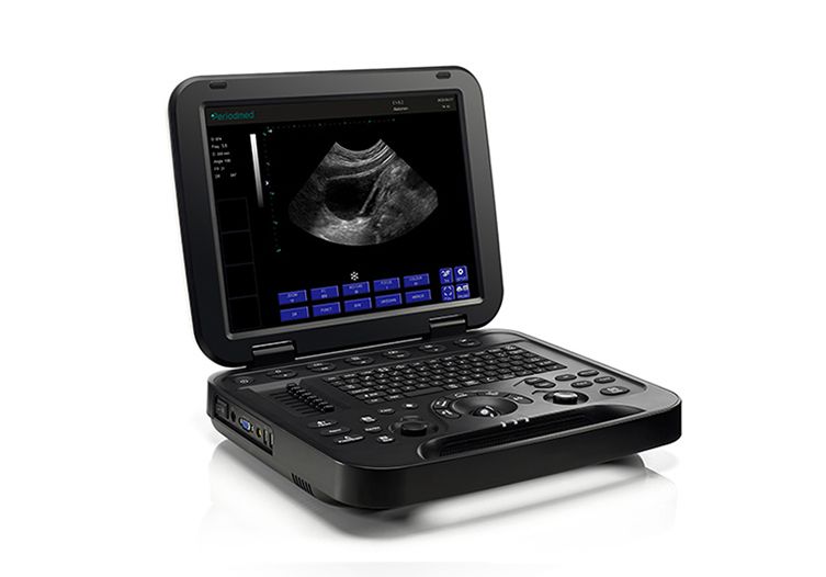 Ultrasound