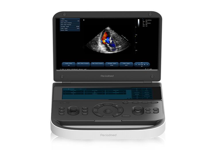 Ultrasound