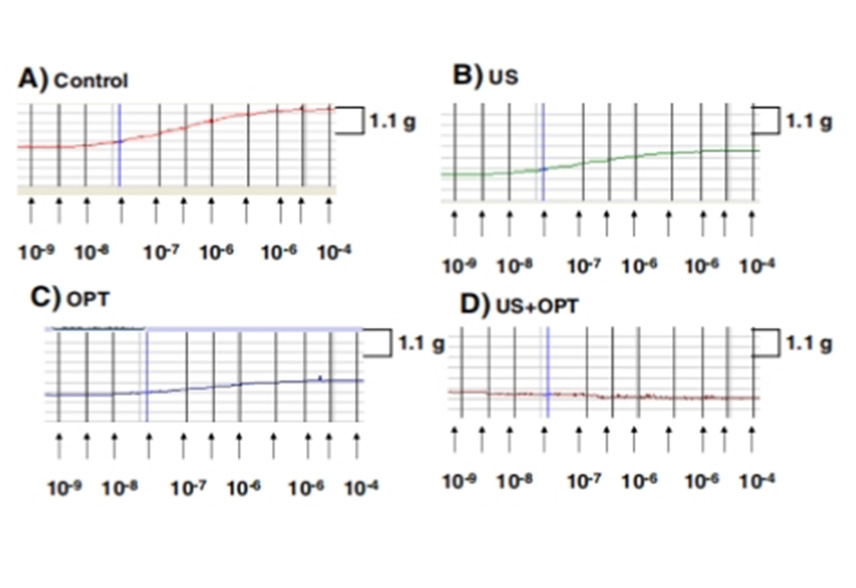 Effects of ultrasound and ultrasound contrast agent on vascular tissue.