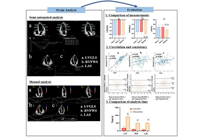 Feasibility and reproducibility  of semi-automated longitudinal strain analysis:  a comparative study with conventional manual  strain analysis