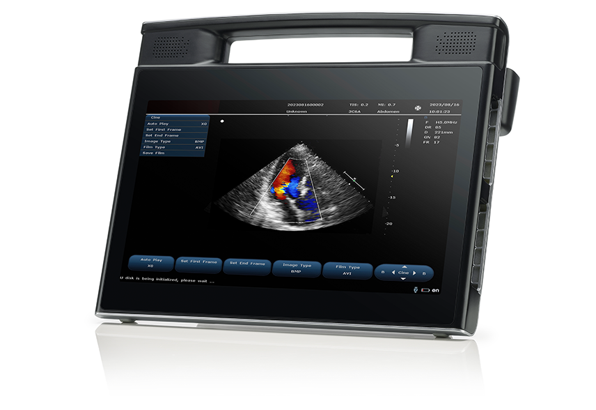 The Rising Demand for Portable Ultrasound Devices in Global Healthcare