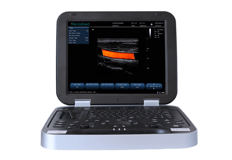 High-Precision Ultrasound Imaging in Chronic Disease Management