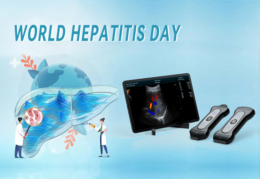 world hepatitis day observed
