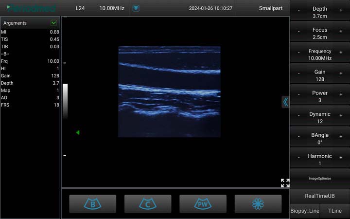 人：线阵探头，B模式，颈动脉 Linear Probe，B Mode，Carotid