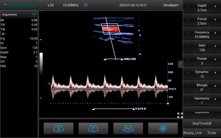 人：线阵探头，脉冲多普勒模式，颈动脉 Linear Probe，PW Mode，Carotid