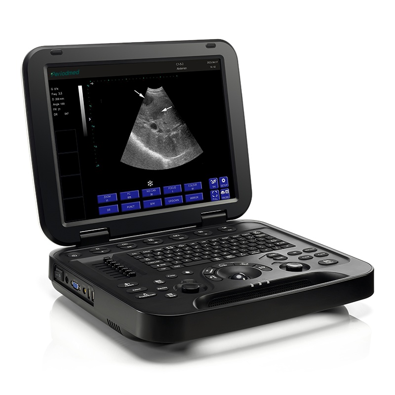 Digital Diagnostic Ultrasound System PU-DL151A