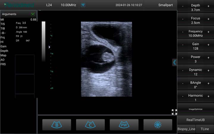 牛-线阵-B模式-妊娠 Linear Probe-B Mode- Pregnant 1 Cow