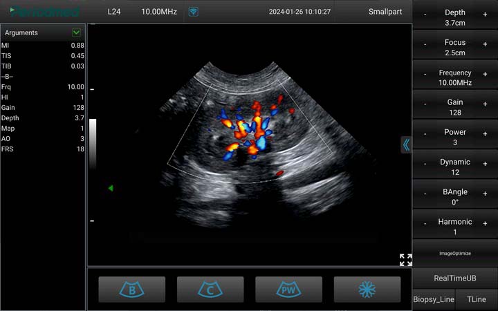 （狗）微凸探头-彩色多普勒模式-肾脏 Micro-convex Probe-Color Doppler Mode-Kidney Dog