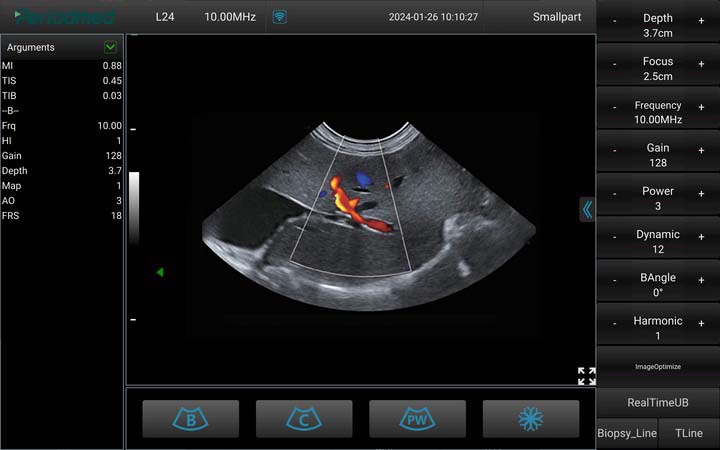 （猫）微凸探头-彩色多普勒模式-肝脏 Micro-convex Probe-Color Doppler Mode-Liver Cat