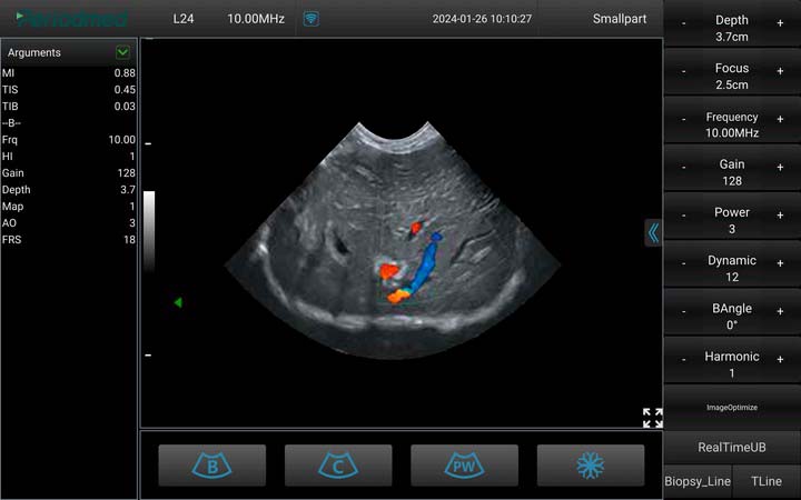 兽：微凸探头，彩色多普勒模式，肝脏  Micro-Convex Probe，Color Mode，Liver