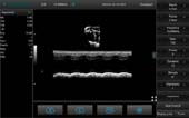 鼠-微凸探头-M模式-心脏 Micro-convex Probe-M Mode-Cardiac Mouse