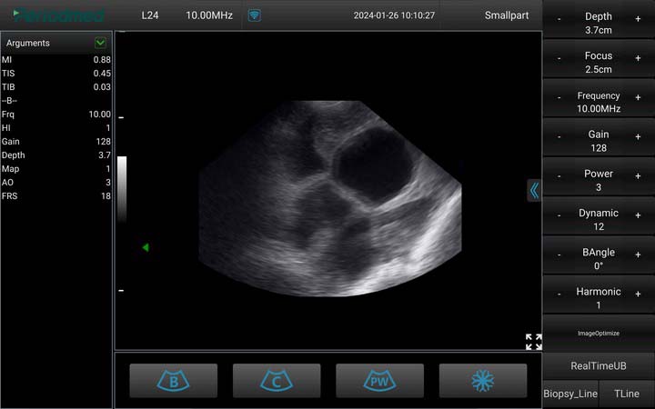 （猪）凸阵探头-B模式-子宫受孕 Convex Probe-B Mode-Uterus1 Pig