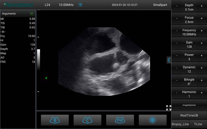 （猪）凸阵探头-B模式-子宫受孕 Convex Probe-B Mode-Uterus2 Pig