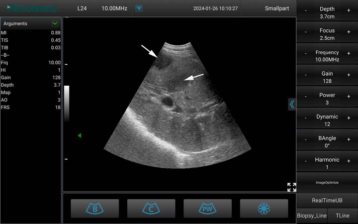 马-凸阵-B模式-肝脏 Convex Probe-B Mode- Right Liver 1 Horse