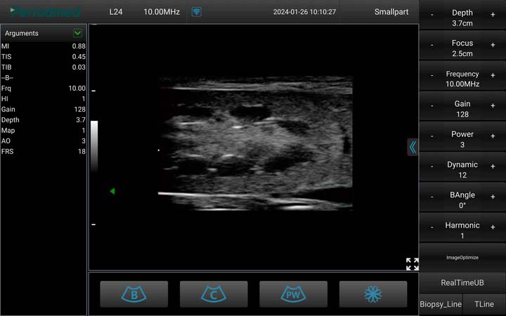 兽：微凸探头，B模式，肾脏  Micro-Convex Probe，B Mode，Kidney