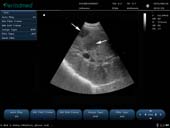 马-凸阵-B模式-肝脏 Convex Probe-B Mode- Right Liver 1 Horse