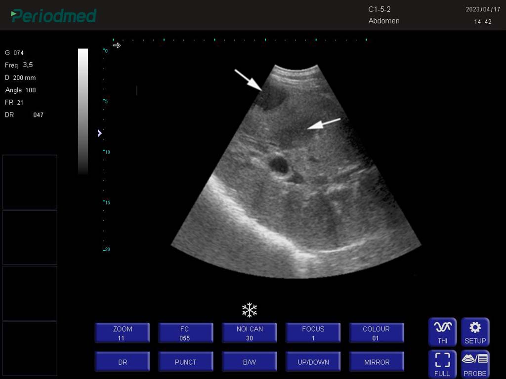 马-凸阵-B模式-肝脏 Convex Probe-B Mode- Right Liver 1 Horse