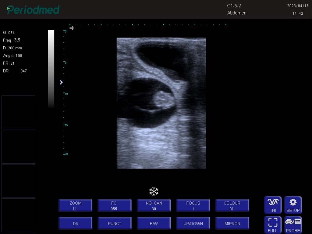 牛-线阵-B模式-妊娠 Linear Probe-B Mode- Pregnant 1 Cow