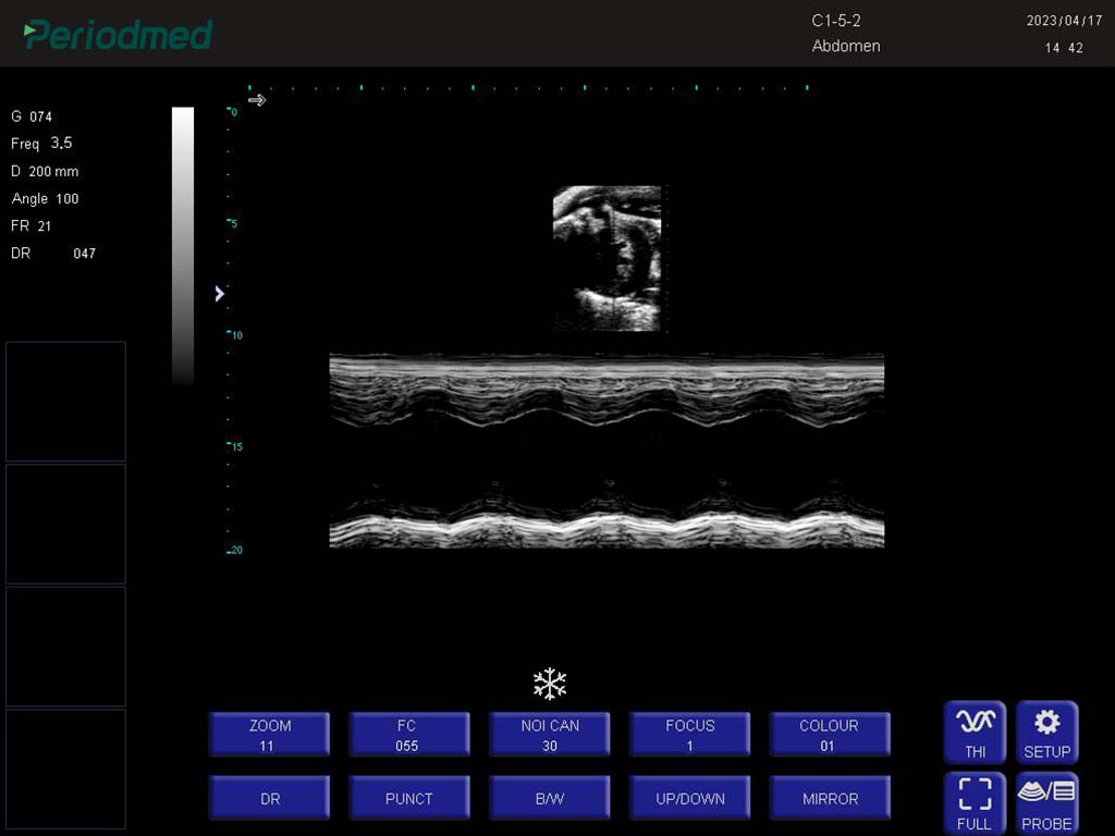 鼠-微凸探头-M模式-心脏 Micro-convex Probe-M Mode-Cardiac Mouse