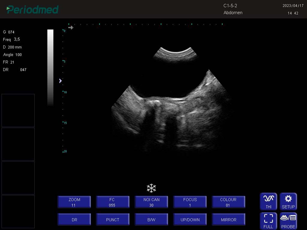 狗-凸阵-B模式-膀胱 Convex Probe-B Mode-Bladder  Dog