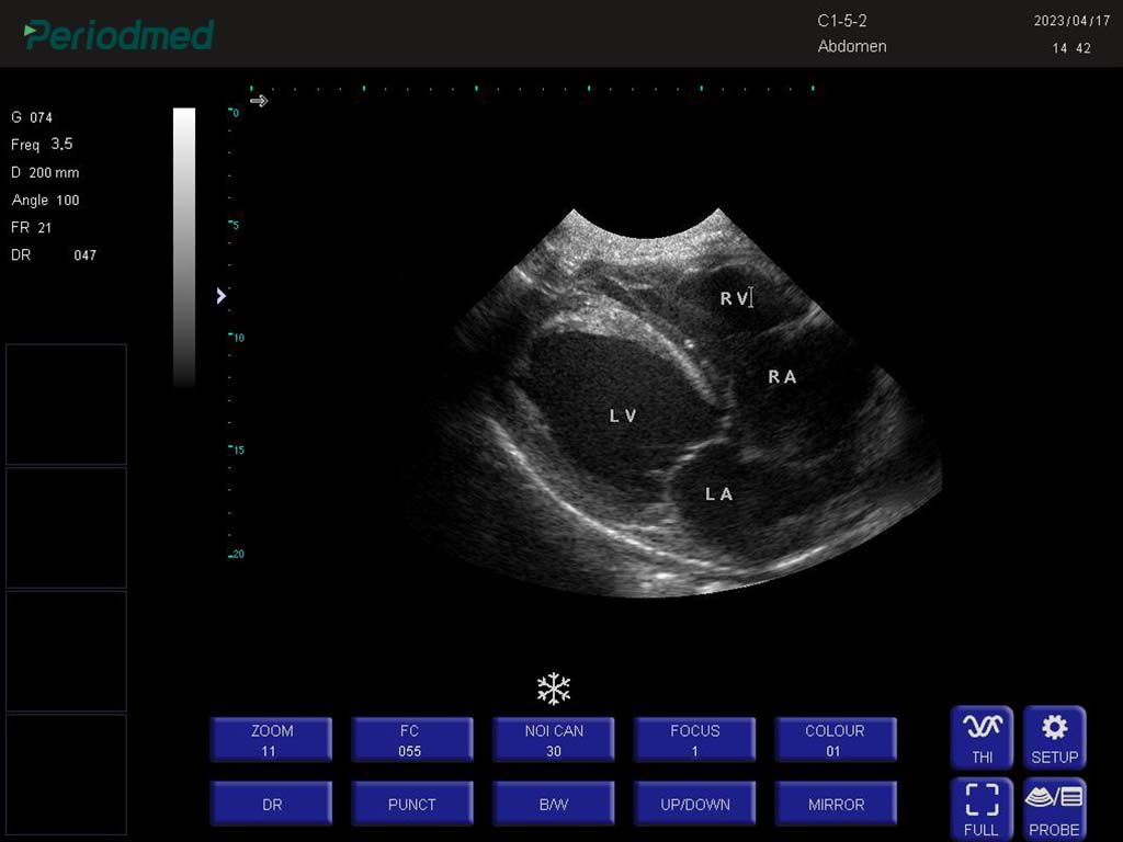 猫-凸阵-B模式-心脏 Convex Probe-B Mode-Cardiac Cat