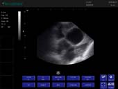 （猪）凸阵探头-B模式-子宫受孕 Convex Probe-B Mode-Uterus1 Pig