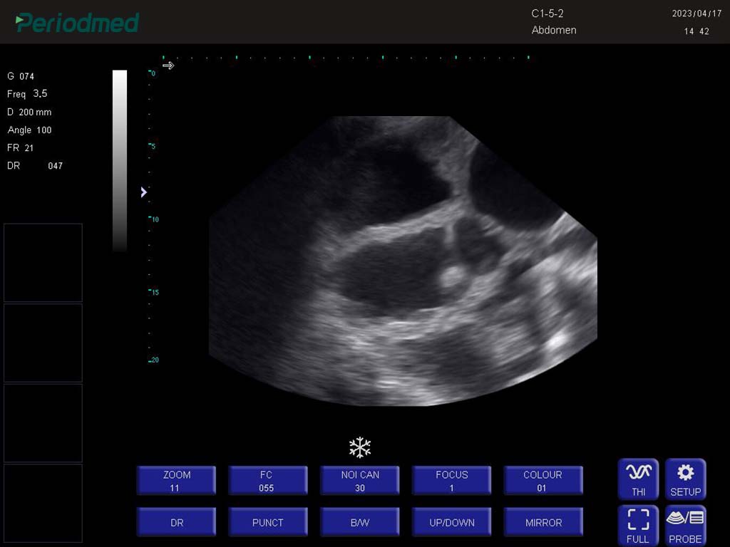 （猪）凸阵探头-B模式-子宫受孕 Convex Probe-B Mode-Uterus2  Pig