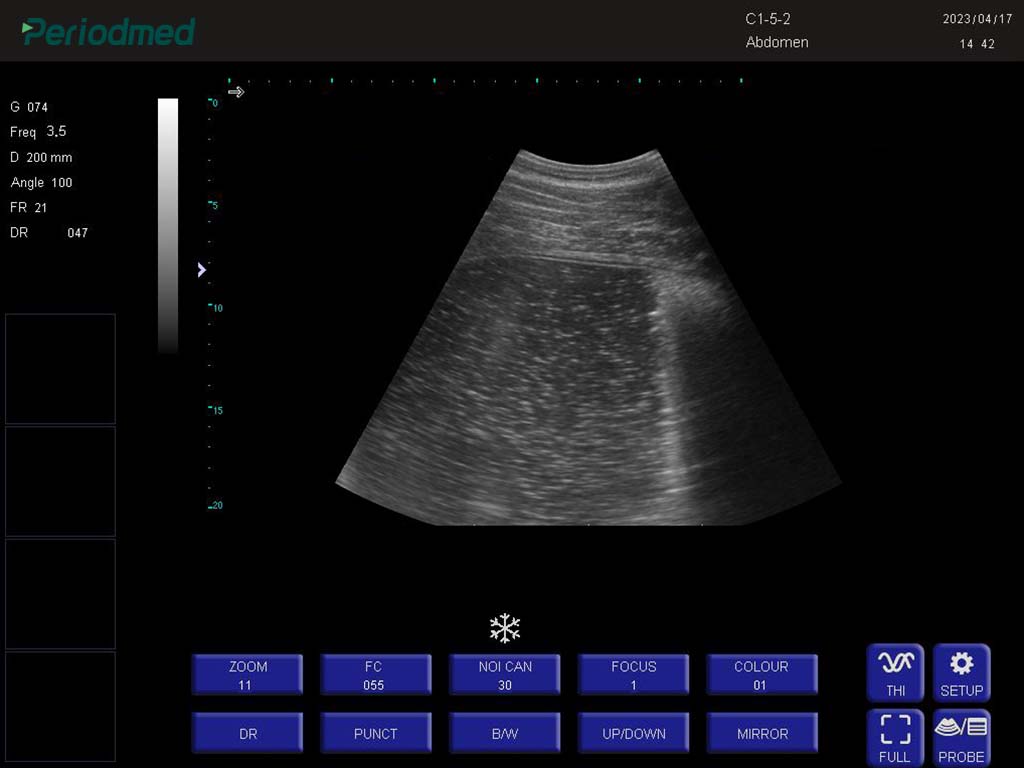 马-凸阵-B模式-胃 Convex Probe-B Mode- Stomach Horse