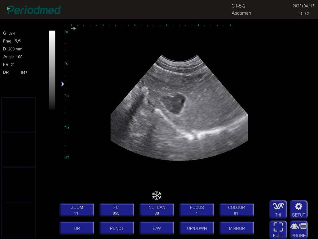 猫-凸阵-B模式-肝脏 Convex Probe-B Mode-Liver Cat