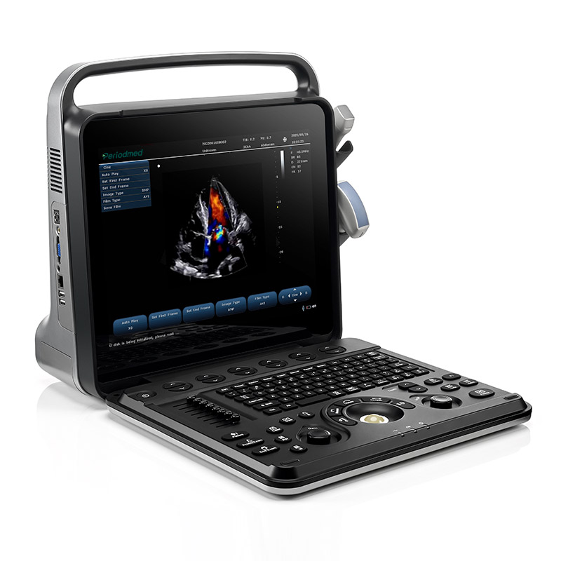 Dedicated Portable Ultrasound System PU-P151A