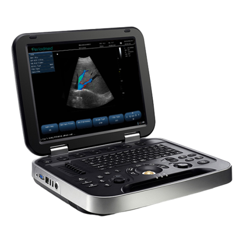 Portable Color Doppler Ultrasound System PU-L151B