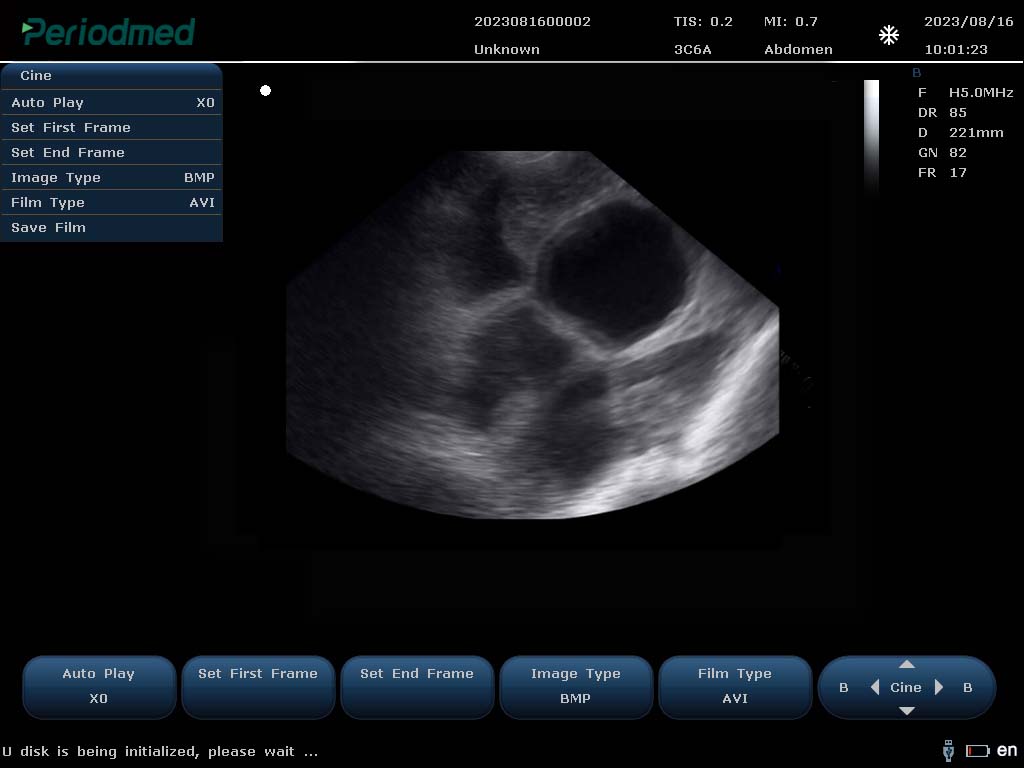 （猪）凸阵探头-B模式-子宫受孕 Convex Probe-B Mode-Uterus1 Pig