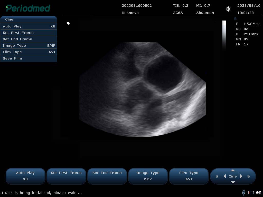 （猪）凸阵探头-B模式-子宫受孕 Convex Probe-B Mode-Uterus2 Pig