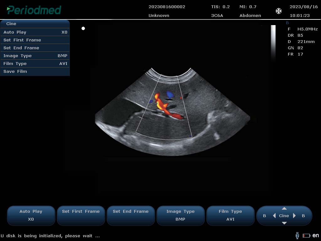 （猫）微凸探头-彩色多普勒模式-肝脏 Micro-convex Probe-Color Doppler Mode-Liver Cat