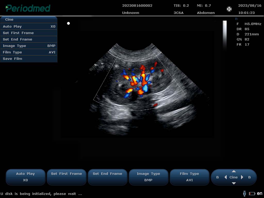 （狗）微凸探头-彩色多普勒模式-肾脏 Micro-convex Probe-Color Doppler Mode-Kidney Dog