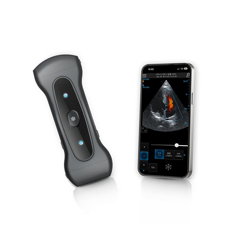 Wireless&Handheld Color Ultrasound System Aura